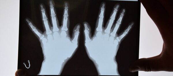 俄羅斯科學家開發出體溶性骨植入物 - 俄羅斯衛星通訊社