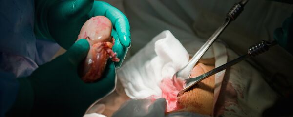 供体肾移植 - 俄罗斯卫星通讯社