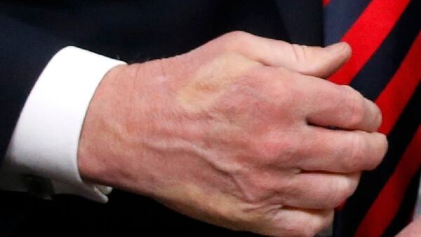 G7峰會上 馬克龍與特朗普握手並留下了“印記” - 俄羅斯衛星通訊社