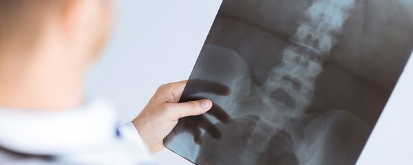 Доктор рассматривает рентген-снимок - 俄罗斯卫星通讯社