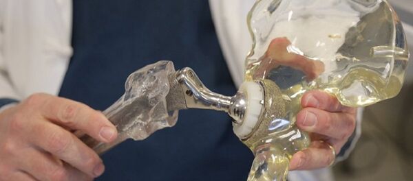 искусственный сустав искусственный сустав - 俄羅斯衛星通訊社