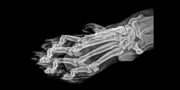 虎爪的X射线成像 - 俄罗斯卫星通讯社