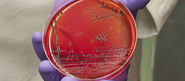 沙门氏菌 沙门氏菌 - 俄罗斯卫星通讯社