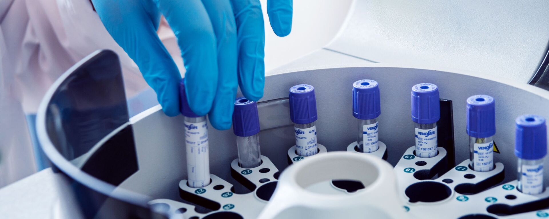 俄生物医学署：新型俄产抗癌药物疗效显著 - 俄罗斯卫星通讯社, 1920, 21.01.2026