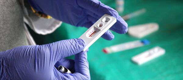 Лабораторный тест на ВИЧ - 俄罗斯卫星通讯社