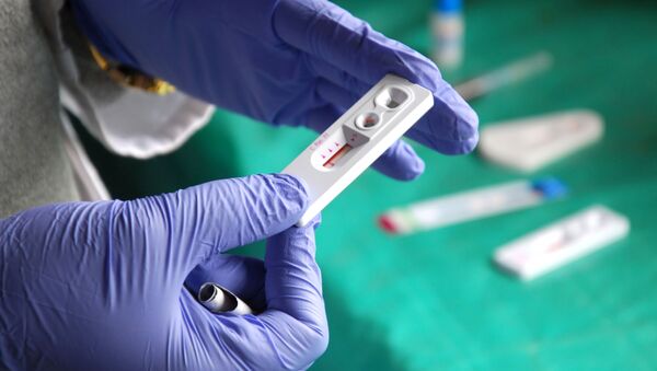 Лабораторный тест на ВИЧ - 俄罗斯卫星通讯社