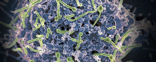 埃博拉病毒 - 俄罗斯卫星通讯社