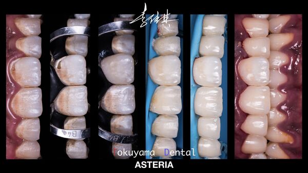 李佳其治療過的病例 李佳其治療過的病例 - 俄羅斯衛星通訊社