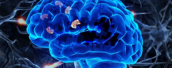 阿尔茨海默病 - 俄罗斯卫星通讯社