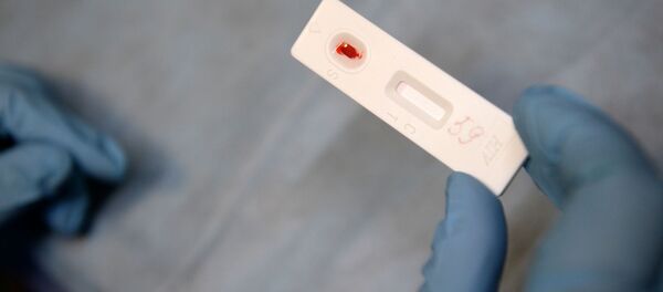 Экспресс-анализ крови на ВИЧ - 俄罗斯卫星通讯社