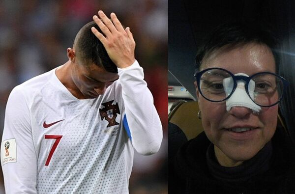 尤文图斯女球迷被罗纳尔多踢出的球击中鼻梁 - 俄罗斯卫星通讯社