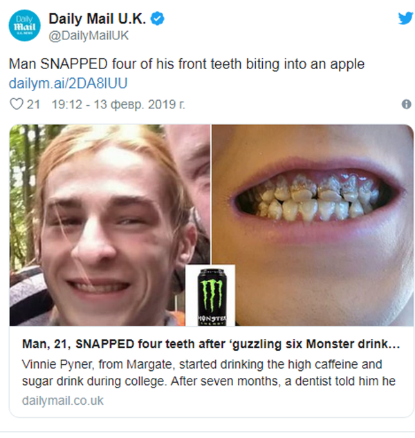 英国男子过度饮用功能饮料牙齿全坏 - 俄罗斯卫星通讯社