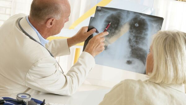 Врач показывает рентгеновский снимок легких пациенту - 可是令他意外