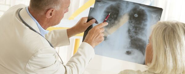 Врач показывает рентгеновский снимок легких пациенту - 俄罗斯卫星通讯社