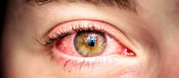 华媒：台湾女子调高亮度玩手机 两年来角膜被灼伤500个洞 - 俄罗斯卫星通讯社