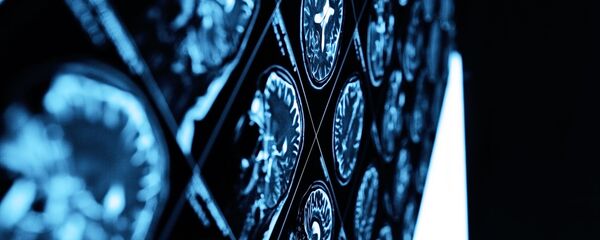 МРТ-снимок головного мозга - 俄罗斯卫星通讯社