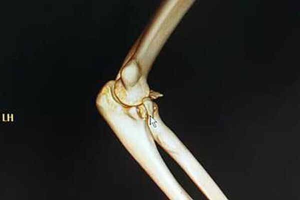 男子“520”給女友公主抱結果手臂骨折 男子“520”給女友公主抱結果手臂骨折 - 俄羅斯衛星通訊社