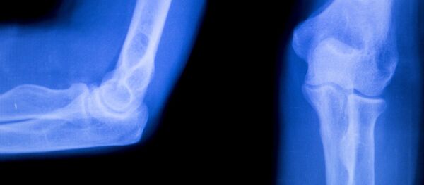 Рентгеновский снимок руки - 俄罗斯卫星通讯社