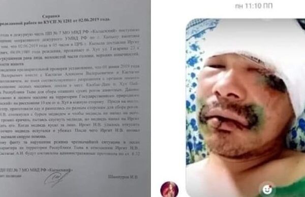 咬熊的舌頭!一名圖瓦居民在針葉林中與熊激鬥並活了下來 咬熊的舌頭!一名圖瓦居民在針葉林中與熊激鬥並活了下來 - 俄羅斯衛星通訊社