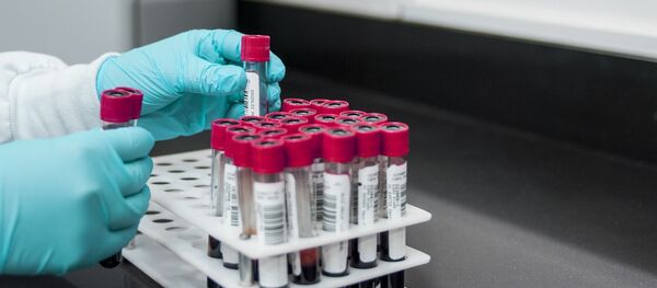 日本開始採用滴血檢測13種癌症的方法 準確率達99% - 俄羅斯衛星通訊社