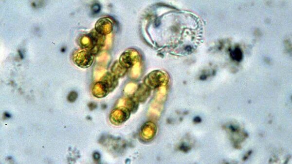 Цианобактерии Anabaena spiroides - 俄罗斯卫星通讯社