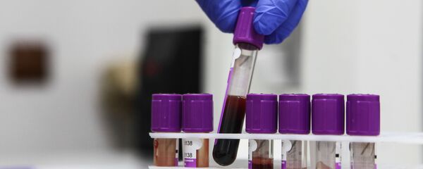 Пробирки с образцами крови для исследований - 俄罗斯卫星通讯社