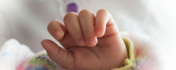 印度诞生“美人鱼”宝宝 - 俄罗斯卫星通讯社