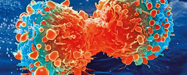 癌症細胞 - 俄羅斯衛星通訊社