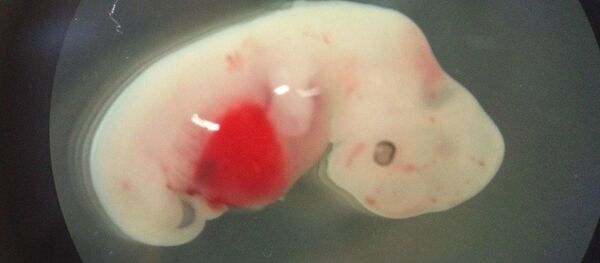 日本政府批准有争议的人兽杂交胚胎计划 - 俄罗斯卫星通讯社