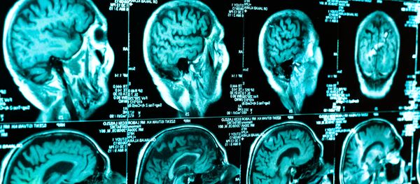 КТ сканирование мозга человека - 俄罗斯卫星通讯社