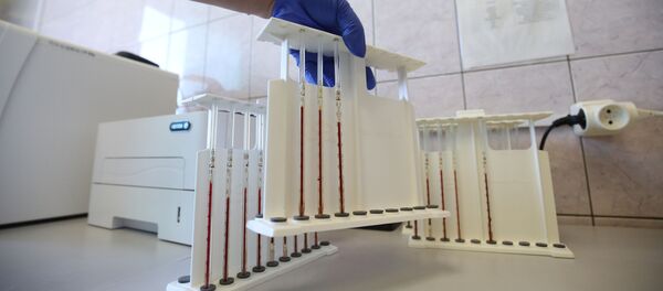 Пробирки с анализами крови - 俄羅斯衛星通訊社