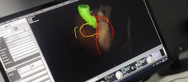 数学模拟血流：心血管疾病现代诊断学的未来 - 俄罗斯卫星通讯社