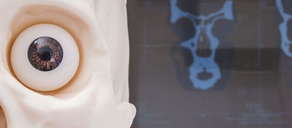 Макет человеческого черепа с глазом на фоне МРТ - 俄罗斯卫星通讯社