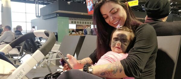 脸上长黑斑胎记的美国女婴已在俄罗斯做手术 - 俄罗斯卫星通讯社