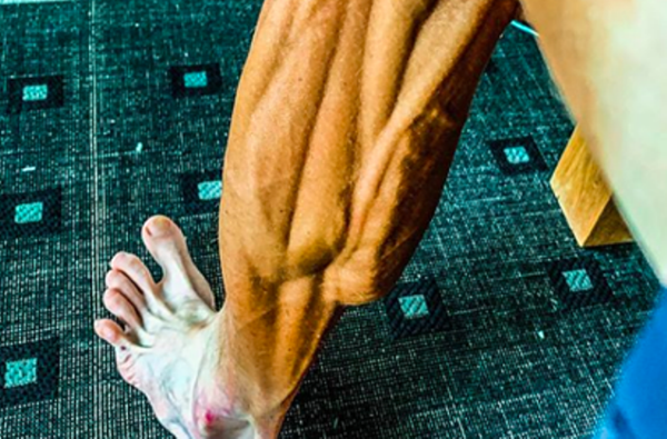 著名自行车手发布腿部照片 吓坏粉丝 - 俄罗斯卫星通讯社