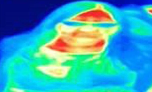 英国女子逛博物馆竟测出乳腺癌 - 俄罗斯卫星通讯社