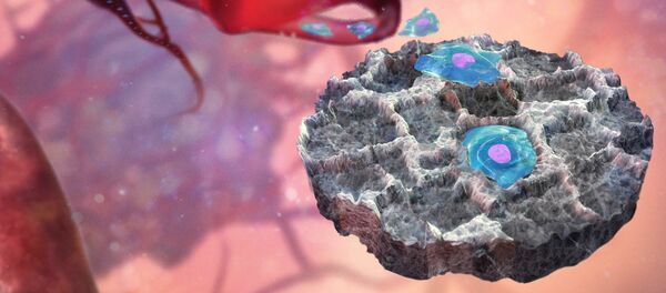 Ловушка для раковых клеток - 俄罗斯卫星通讯社