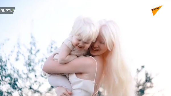 Двое из ларца: сестры-альбиносы из Казахстана покоряют соцсети - 俄羅斯衛星通訊社