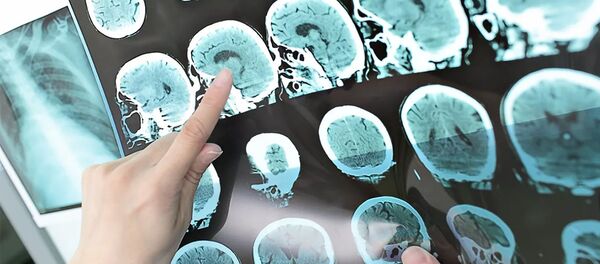 Результаты кт головного мозга - 俄罗斯卫星通讯社