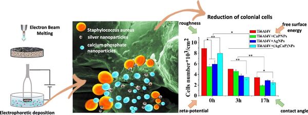 俄羅斯學者的新發現有助於製造安全的個性化移植物 俄羅斯學者的新發現有助於製造安全的個性化移植物 - 俄羅斯衛星通訊社
