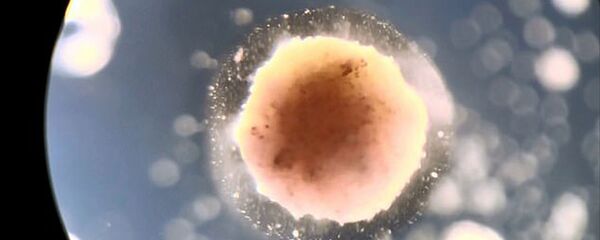 Живой робот, лечащий рак - 俄罗斯卫星通讯社