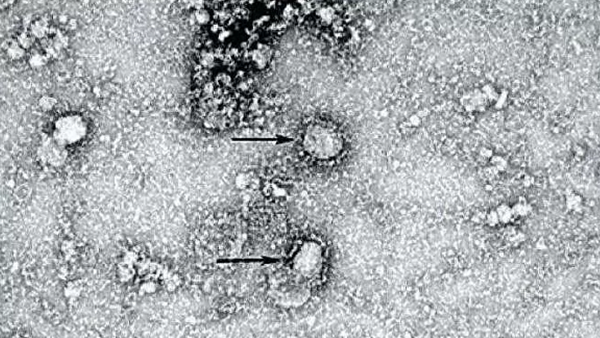 澳科學家培育出新型冠狀病毒 - 俄羅斯衛星通訊社