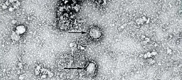 澳科学家培育出新型冠状病毒 - 俄罗斯卫星通讯社