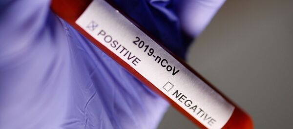 Тест на коронавирус Тест на коронавирус - 俄罗斯卫星通讯社
