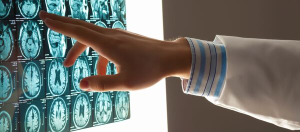 Врач указывает на снимок головы пациента - 俄罗斯卫星通讯社