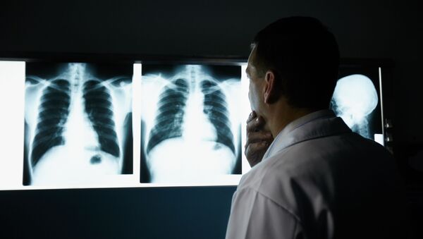 Врач осматривает рентгеновские снимки грудной клетки - 俄羅斯衛星通訊社
