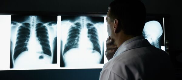 Врач осматривает рентгеновские снимки грудной клетки - 俄罗斯卫星通讯社