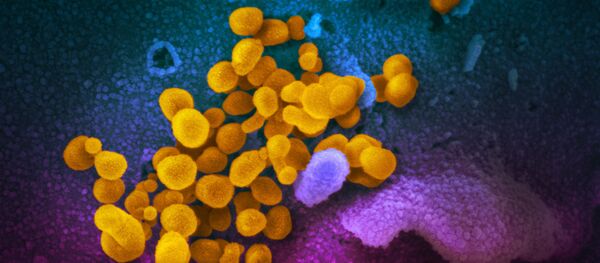 Цветное изображение нового коронавируса SARS-CoV-2  - 俄罗斯卫星通讯社