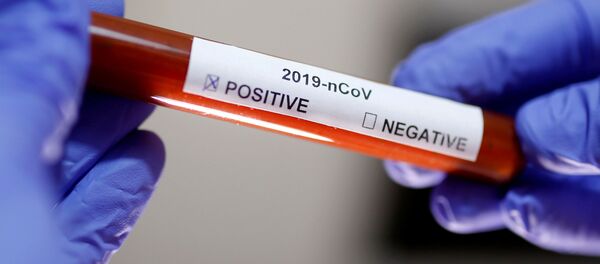 Тест на коронавирус - 俄罗斯卫星通讯社