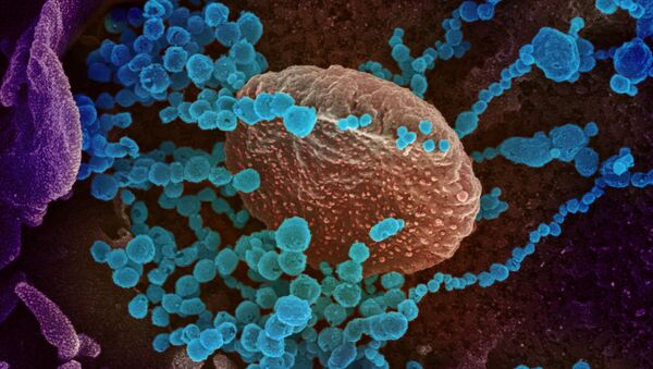 Вид на зараженную коронавирусом  клетку под микроскопом  - 俄罗斯卫星通讯社